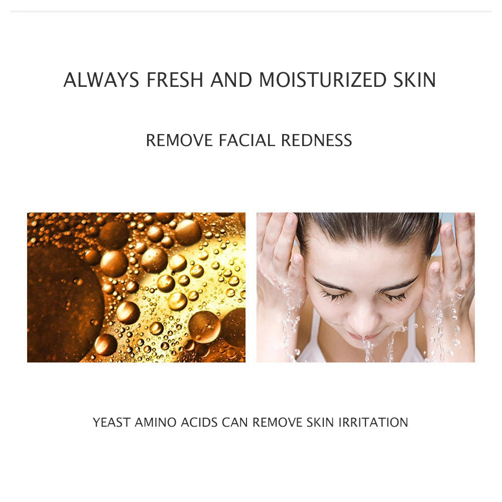 JOMTAM Amino Acid Cleansing Facial Anti-Acne Essence Moisturizing Removed Mites